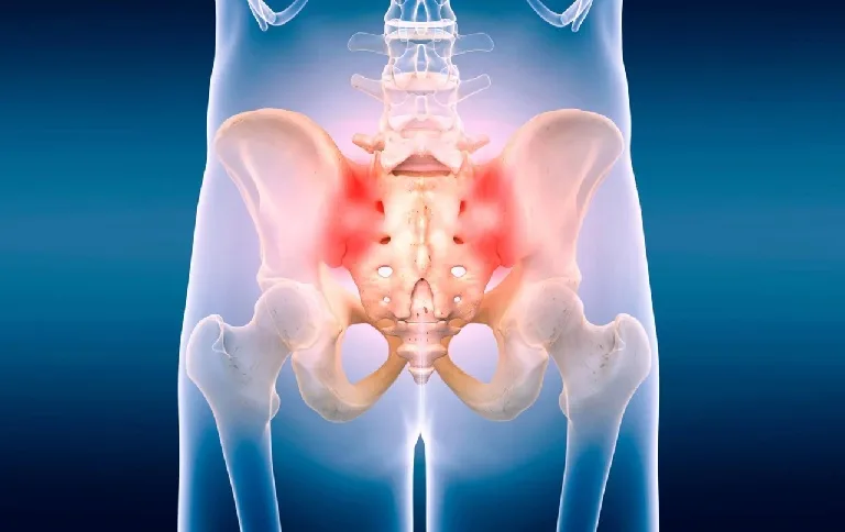 Finding Relief Where It Hurts Most: How Sacroiliac Joint Fusion Can Restore Your Quality of Life Finding Relief Where It Hurts Most: How Sacroiliac Joint Fusion Can Restore Your Quality of Life
